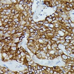 CD64/FCGR1B Antibody - Azide and BSA Free, Novus Biologicals 0.1 mL, Unconjugated:Antibodies,