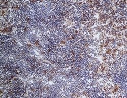 CD68/SR-D1 Antibody (FA-11) - Azide and BSA Free, Novus Biologicals 0.1