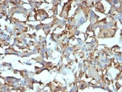 Novus Biologicals CD68/SR-D1 Antibody (KP1 + C68/684) - Azide and BSA Free, Novus Biologicals 0.1 mg | Buy Online | Novus Biologicals | Fisher Scientific