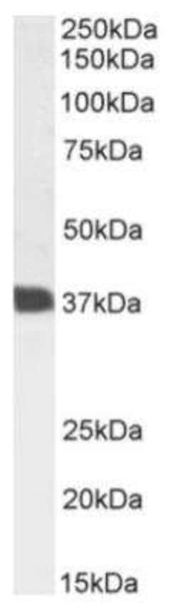 CD7, Rabbit anti-Human, Clone: 3A1E, Novus Biologicals 0.2 mg | Buy Online | Novus Biologicals | Fisher Scientific