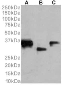 CD74 Rabbit anti-Human, Mouse, Rat, Clone: LN-2, Novus Biologicals:Antibodies:Primary