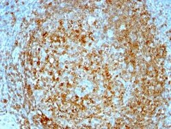 CD74 Antibody (CLIP/813), Novus Biologicals:Antibodies:Primary Antibodies