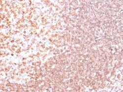 CD74 Antibody (SPM523) - Azide and BSA Free, Novus Biologicals 0.1 mg;