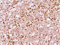 CD79A Antibody (IGA/1688R), Novus Biologicals 100&mu;g; Unlabeled:Antibodies,