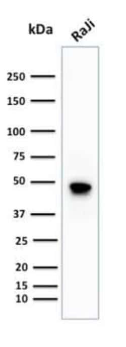 CD79A Antibody (IGA/1688R), Novus Biologicals 100&mu;g; Unlabeled:Antibodies,