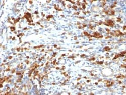 CD79A Antibody (IGA/764), Novus Biologicals:Antibodies:Primary Antibodies