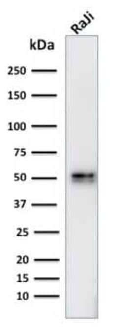 CD79A Antibody (IGA/764), Novus Biologicals:Antibodies:Primary Antibodies