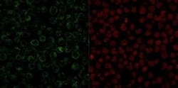 CD79A Antibody (JCB117) - Azide and BSA Free, Novus Biologicals 0.1 mg;