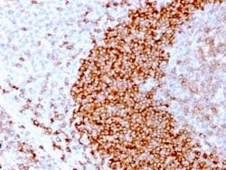 CD79B Rabbit anti-Human, Clone: IGB/3170R, Novus Biologicals:Antibodies:Primary
