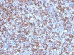 CD8 Antibody (C8/1779R), Novus Biologicals:Antibodies:Primary Antibodies