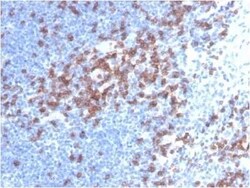 CD8 Antibody (C8/468) - Azide and BSA Free, Novus Biologicals 0.1 mg | Buy Online | Novus Biologicals | Fisher Scientific