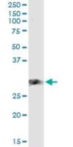 CD83 Antibody (3G10-1F4), Novus Biologicals 0.1 mg | Buy Online | Novus Biologicals | Fisher Scientific