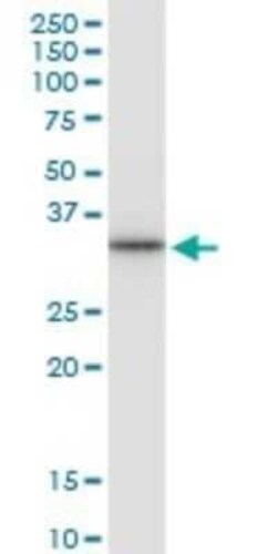 CD83 Antibody (3G10-1F4), Novus Biologicals 0.1 mg | Buy Online | Novus Biologicals | Fisher Scientific
