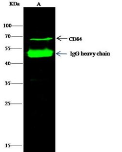 CD84/SLAMF5 Rabbit anti-Human, Clone: 6, Novus Biologicals 50 &mu;g; Unconjugated:Antibodies,