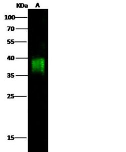 CD84/SLAMF5 Rabbit anti-Human, Clone: 6, Novus Biologicals 50 &mu;g; Unconjugated:Antibodies,