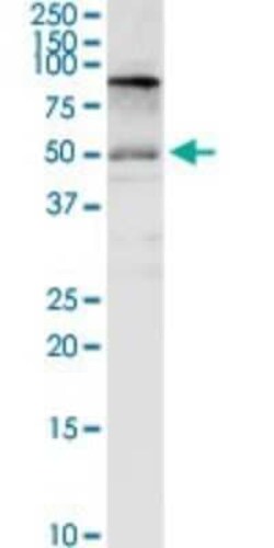 Novus Biologicals CD98 Antibody, Novus Biologicals 0.1 mg | Buy Online | Novus Biologicals&trade; | Fisher Scientific