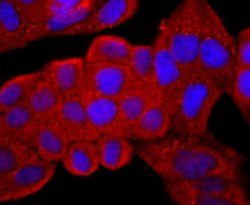 CD99 Rabbit anti-Human, Clone: JF0991, Novus Biologicals 100&mu;L:Antibodies,