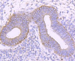 CD99 Rabbit anti-Human, Clone: JF0991, Novus Biologicals 100&mu;L:Antibodies,