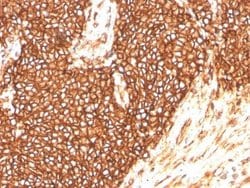 CD99 Antibody (MIC2/3478R) - Azide and BSA Free, Novus Biologicals 100