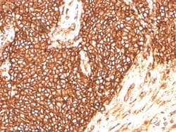 CD99 Rabbit anti-Human, Clone: MIC2/3478R, Novus Biologicals 20 &mu;g;
