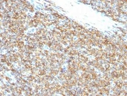 CD99 Antibody (12E7), Novus Biologicals:Antibodies:Primary Antibodies