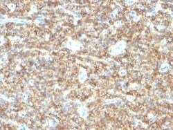 CD99 Antibody (HO36-1.1), Novus Biologicals 0.1 mg, Unconjugated:Antibodies,