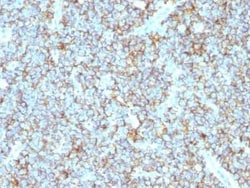 CD99 Antibody (MIC2/1495R), Novus Biologicals 20&mu;g; Unlabeled:Antibodies,