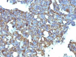 CD99 Antibody (MIC2/877), Novus Biologicals 0.1mg; Unlabeled:Antibodies,