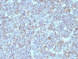 CD99 Antibody (SPM596), Novus Biologicals:Antibodies:Primary Antibodies