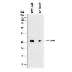 Human CD99 Antibody, R D Systems:Antibodies:Primary Antibodies