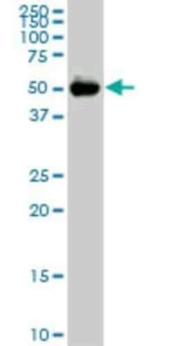 CDADC1 Antibody (2E8), Novus Biologicals 0.1 mg; Unconjugated:Antibodies,