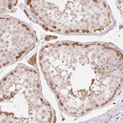 CDC123 Antibody, Novus Biologicals 25ul; Unconjugated:Antibodies, Polyclonal