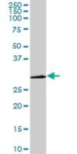 CDC2/CDK1 Antibody (8F1), Novus Biologicals 0.1 mg | Buy Online | Novus Biologicals | Fisher Scientific
