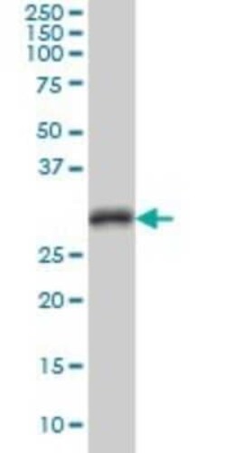 CDC2/CDK1 Antibody (8F1), Novus Biologicals 0.1 mg | Buy Online | Novus Biologicals | Fisher Scientific