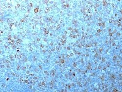 CDC2/CDK1 Antibody (CDK1/873), Novus Biologicals:Antibodies:Primary Antibodies