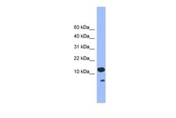 CDC26 Rabbit anti-Human, Polyclonal, Novus Biologicals 0.1 mL; Unconjugated:Antibodies,