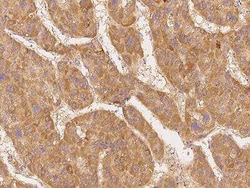 CDC2L1 Antibody, Novus Biologicals:Antibodies:Primary Antibodies