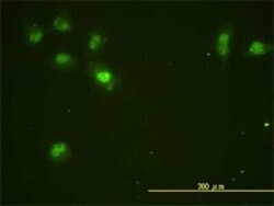 Novus Biologicals CDC2L5 Antibody (1B3-1B11), Novus Biologicals 0.1 mg | Buy Online | Novus Biologicals&trade; | Fisher Scientific