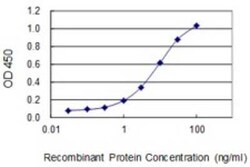 Novus Biologicals CDC2L5 Antibody (1B3-1B11), Novus Biologicals 0.1 mg | Buy Online | Novus Biologicals&trade; | Fisher Scientific