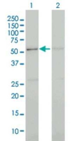 CDC2L5 Antibody (3G1), Novus Biologicals 0.1 mg | Buy Online | Novus Biologicals | Fisher Scientific