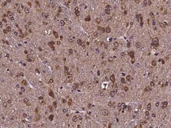 CDC37 Antibody, Novus Biologicals:Antibodies:Primary Antibodies