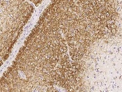 CDC37 Antibody, Novus Biologicals 50 &mu;g, Unconjugated:Antibodies, Polyclonal