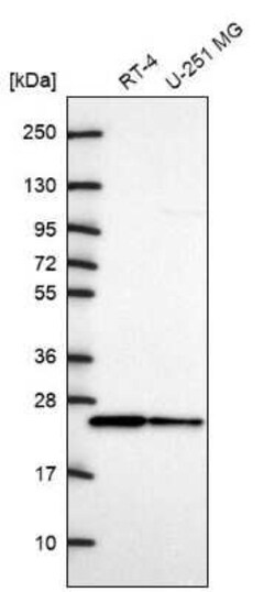CDC42 Antibody, Novus Biologicals:Antibodies:Primary Antibodies