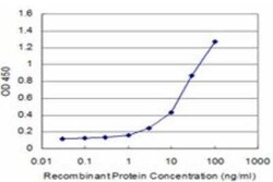 CDC42BPB Antibody (2F4), Novus Biologicals 0.1 mg; Unconjugated:Antibodies,