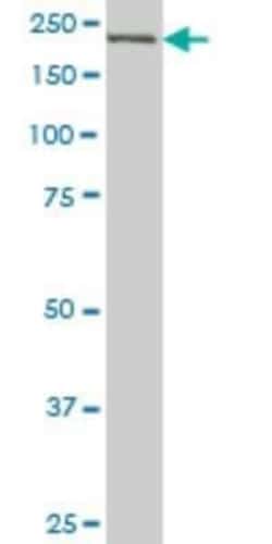 CDC42BPB Antibody (2F4), Novus Biologicals 0.1 mg; Unconjugated:Antibodies,