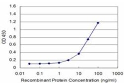 CDC42BPB Antibody (6G3), Novus Biologicals 0.1 mg | Buy Online | Novus Biologicals | Fisher Scientific