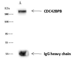 CDC42BPB Antibody, Novus Biologicals 50 &mu;g, Unconjugated:Antibodies,