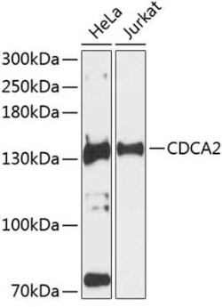 CDCA2 Antibody - Azide and BSA Free, Novus Biologicals:Antibodies:Primary