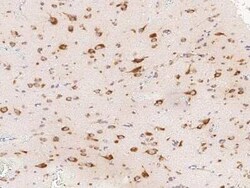 CDCA3 Antibody, Novus Biologicals 50 &mu;g, Unconjugated:Antibodies, Polyclonal