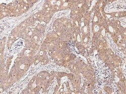 CDCA3 Antibody, Novus Biologicals 50 &mu;g, Unconjugated:Antibodies, Polyclonal